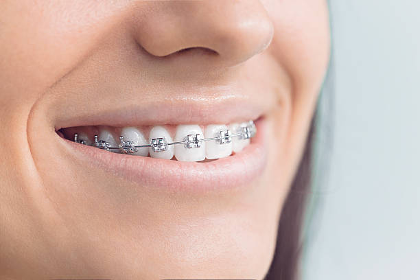 Best Full Mouth Reconstruction  in Shavano Park, TX